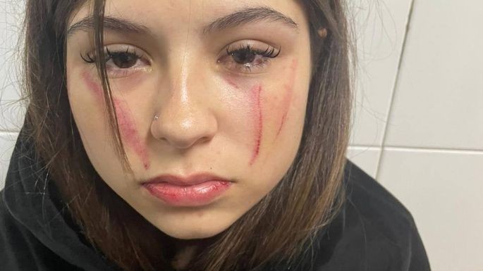 La Pampa: Brutal agresión a una joven de 15 años en un boliche céntrico