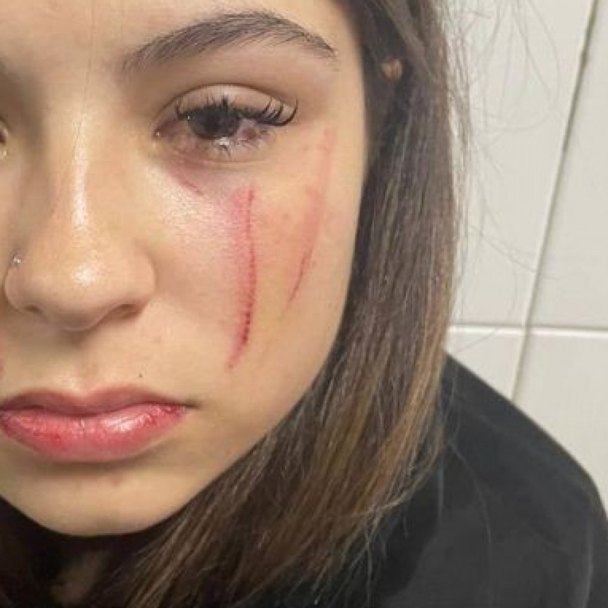 La Pampa: Brutal agresi&oacute;n a una joven de 15 a&ntilde;os en un boliche c&eacute;ntrico