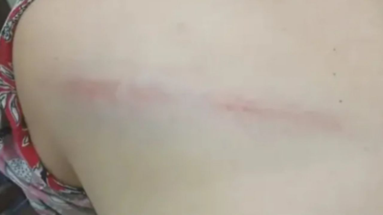 Denunció que su esposo la golpeó con un rebenque tras una discusión por el mate