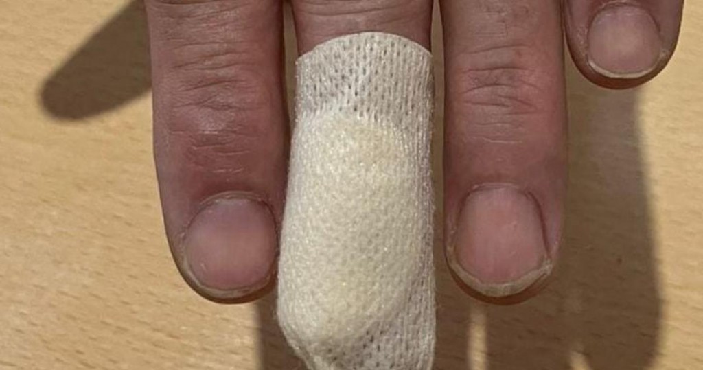 La Pampa: El problema de los perros en la vía publica esta vez un pitbull mordió a un repartidor de Mercado Libre 