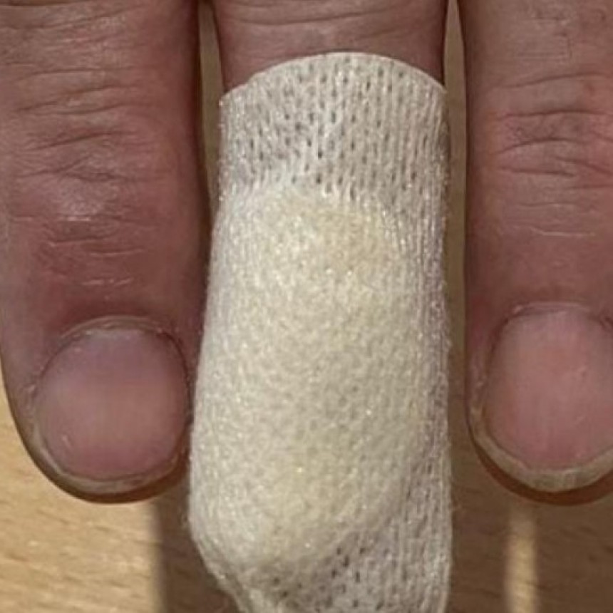 La Pampa: El problema de los perros en la vía publica esta vez un pitbull mordió a un repartidor de Mercado Libre 