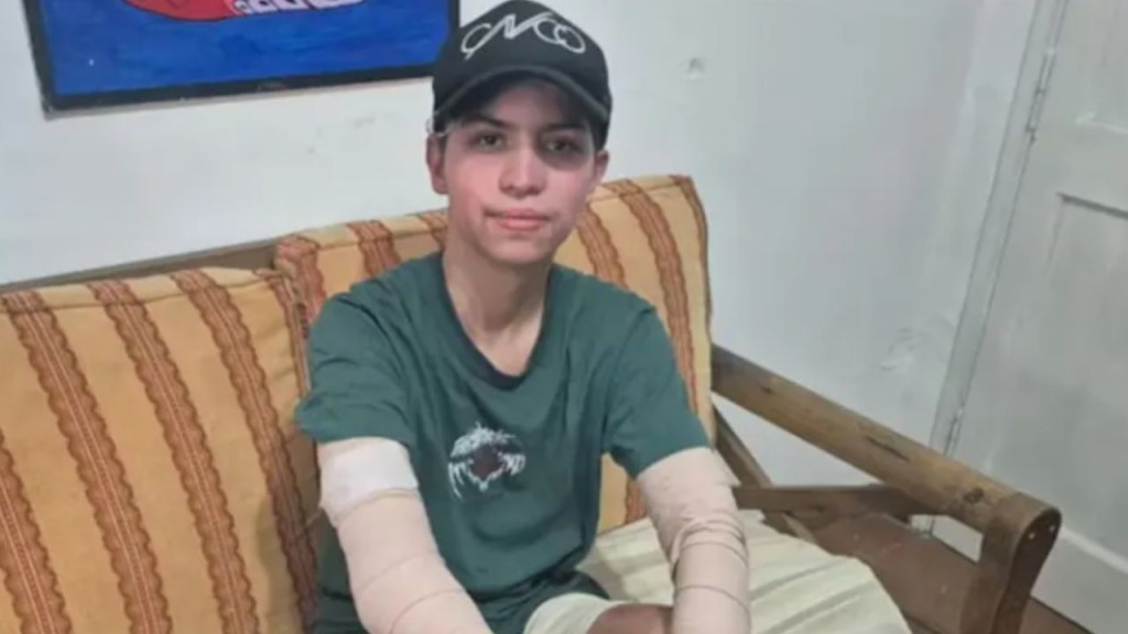 Le explot&oacute; el celular y qued&oacute; con el 68% del cuerpo quemado. Piden suspender la venta del equipo