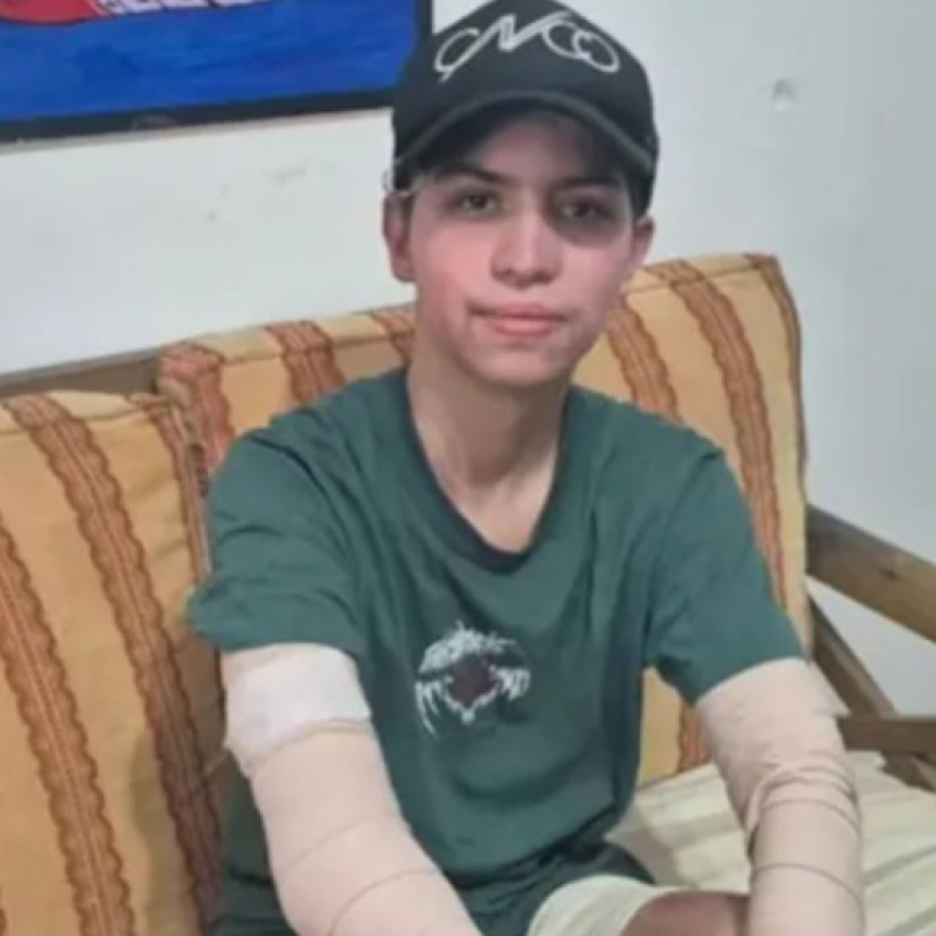 Le explot&oacute; el celular y qued&oacute; con el 68% del cuerpo quemado. Piden suspender la venta del equipo