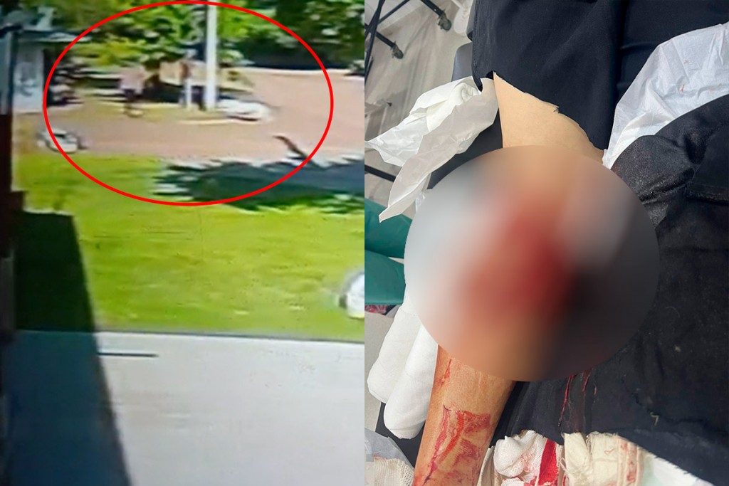 La Pampa: Un perro Dogo le destrozó la pierna a un hombre de 70 años y los vecinos denuncian falta de acción por parte de autoridades