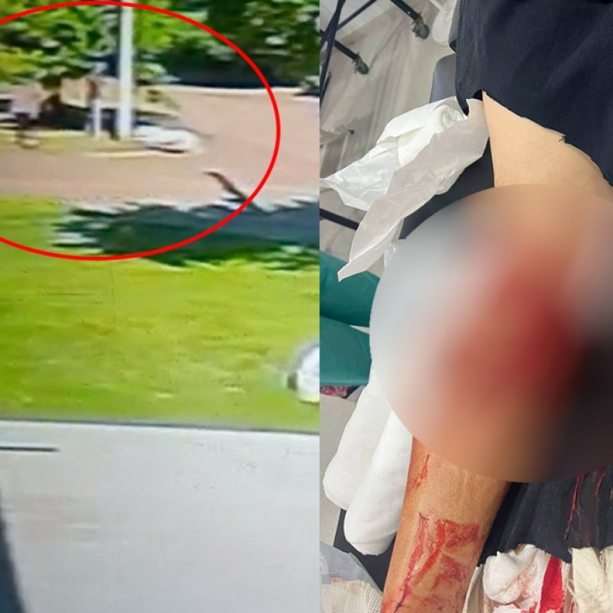 La Pampa: Un perro Dogo le destrozó la pierna a un hombre de 70 años y los vecinos denuncian falta de acción por parte de autoridades