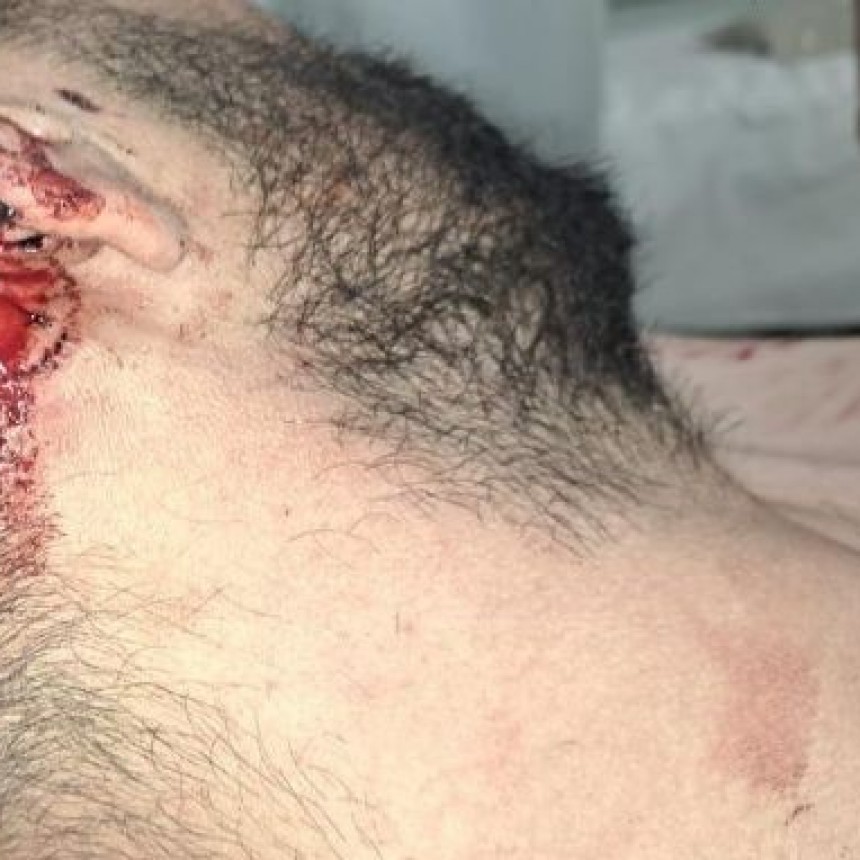 La Pampa: Atac&oacute; a su propio hermano con un pitbull, un cuchillo y un ca&ntilde;o; "te voy a matar"